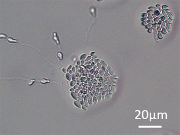 南極産担子菌酵母ムラキア・プロロピスSK-4
